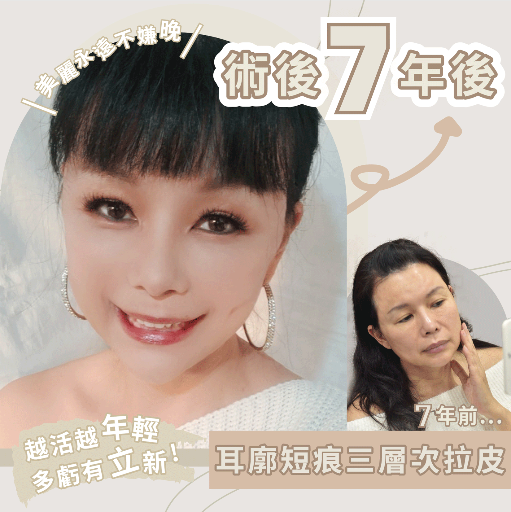術後7年真實案例：耳廓短痕三層次延遲老化