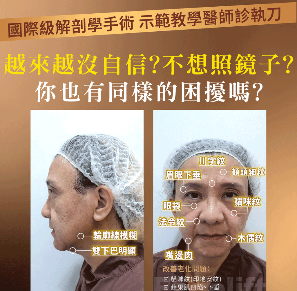 內視鏡拉皮效果