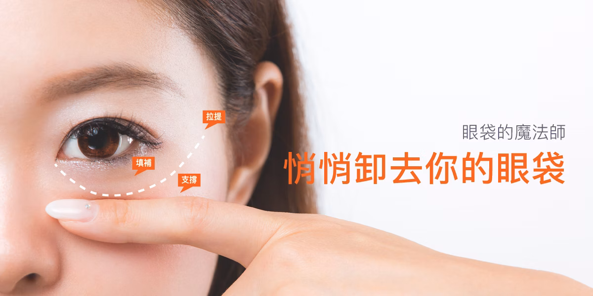 眼袋的魔法師首圖：悄悄卸去眼袋，標示眼袋注射部位