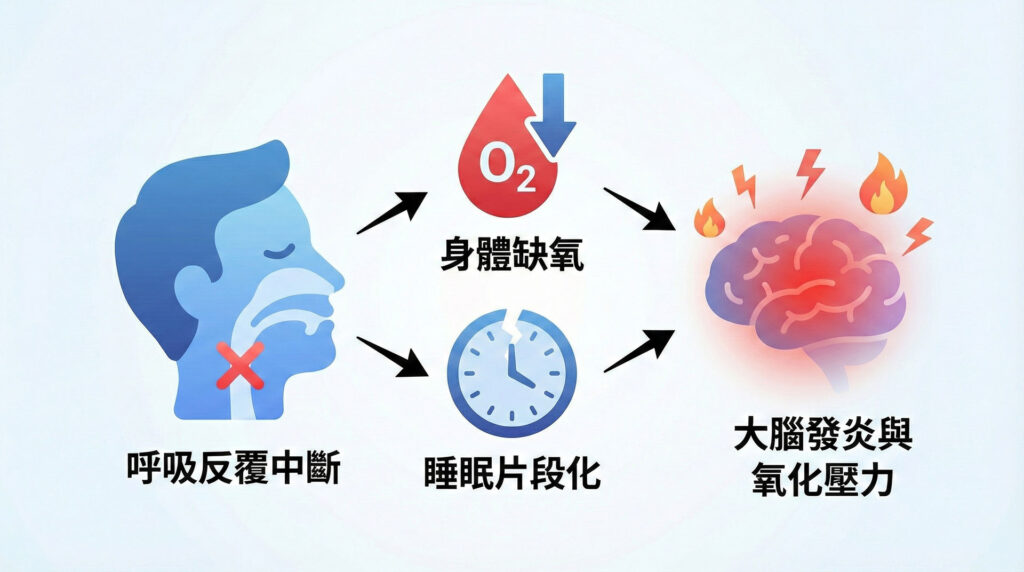 睡眠呼吸中止症示意圖