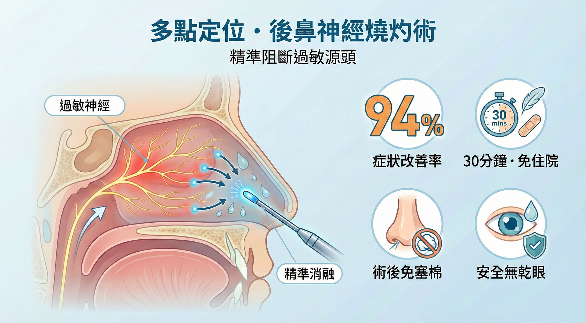 後鼻神經解剖示意圖
