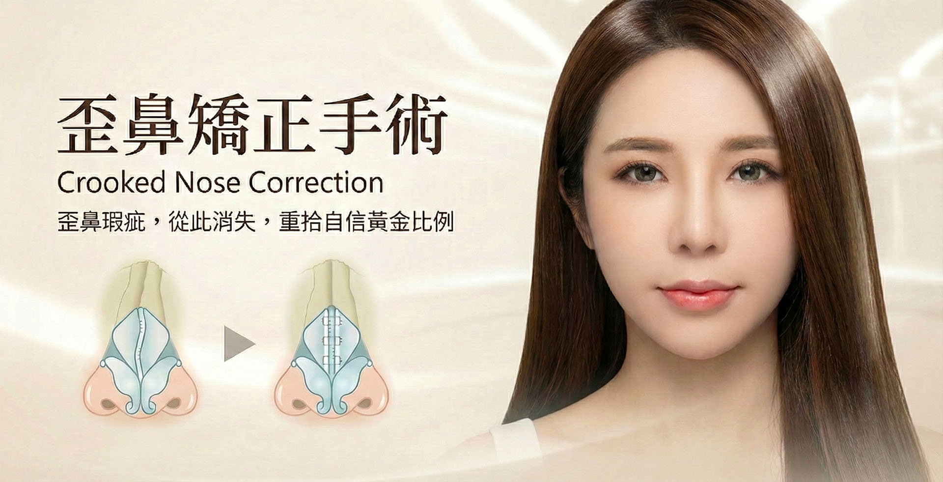 歪鼻矯正手術橫幅:重拾黃金比例廣告圖